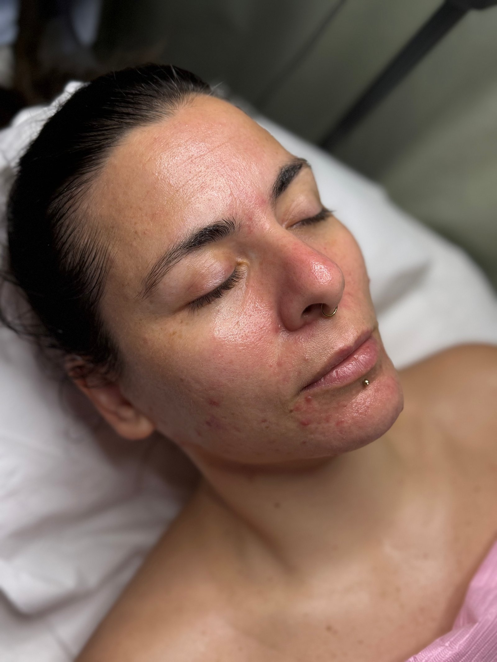 After facial
