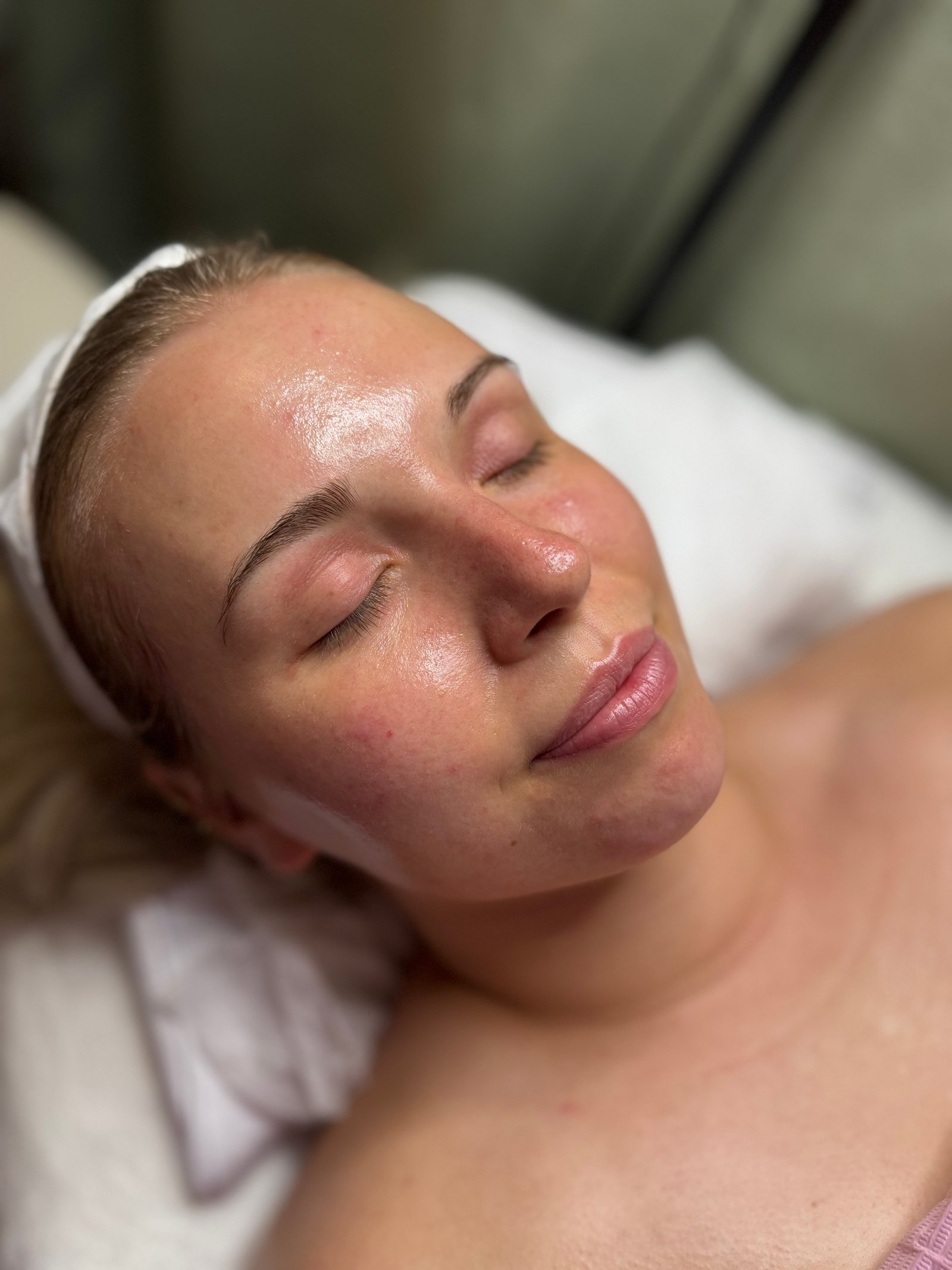 After facial
