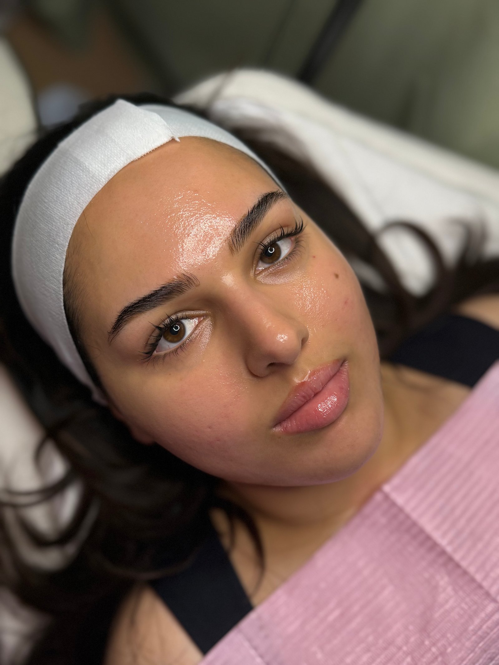 After facial