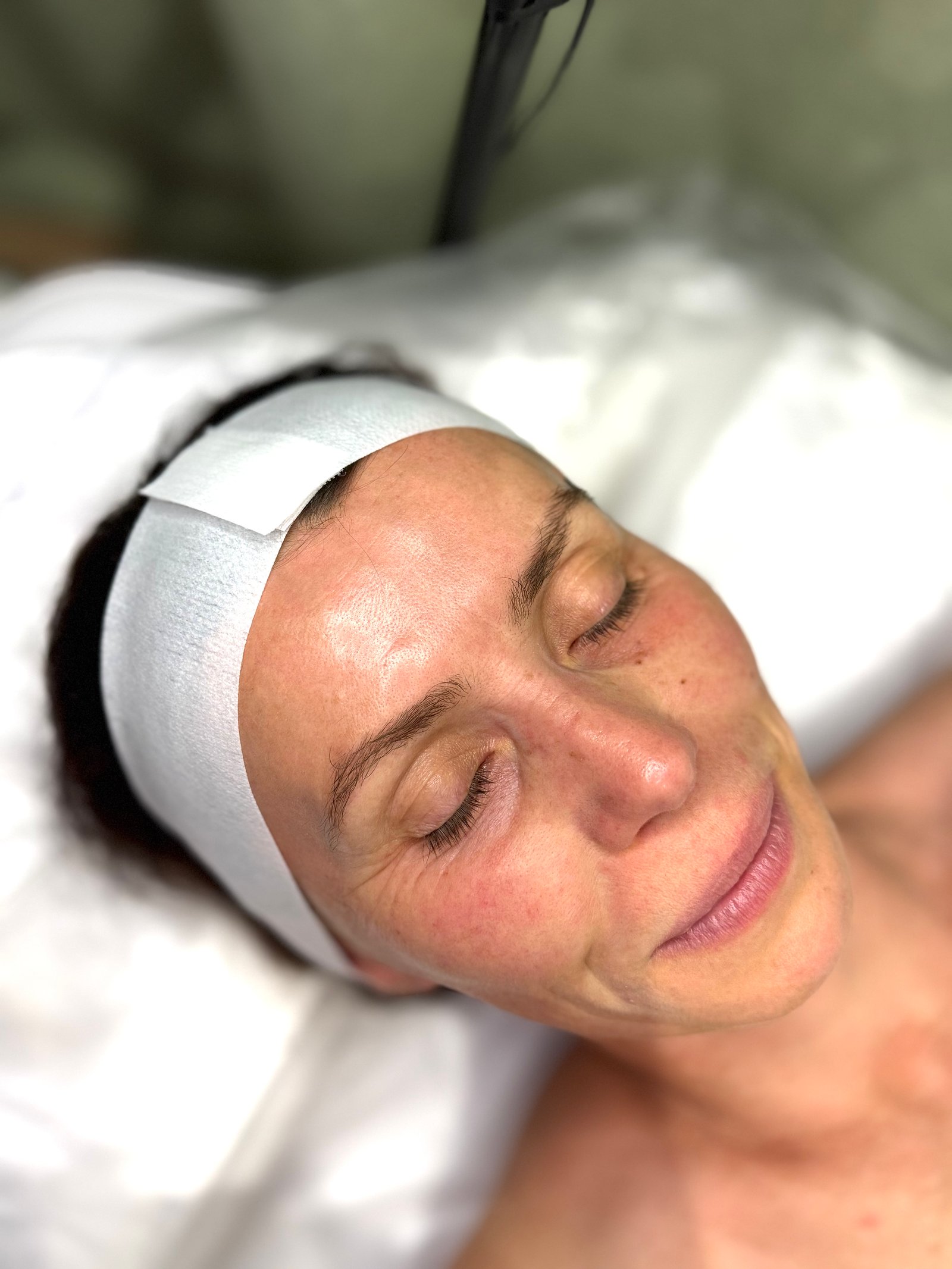 Before skin booster