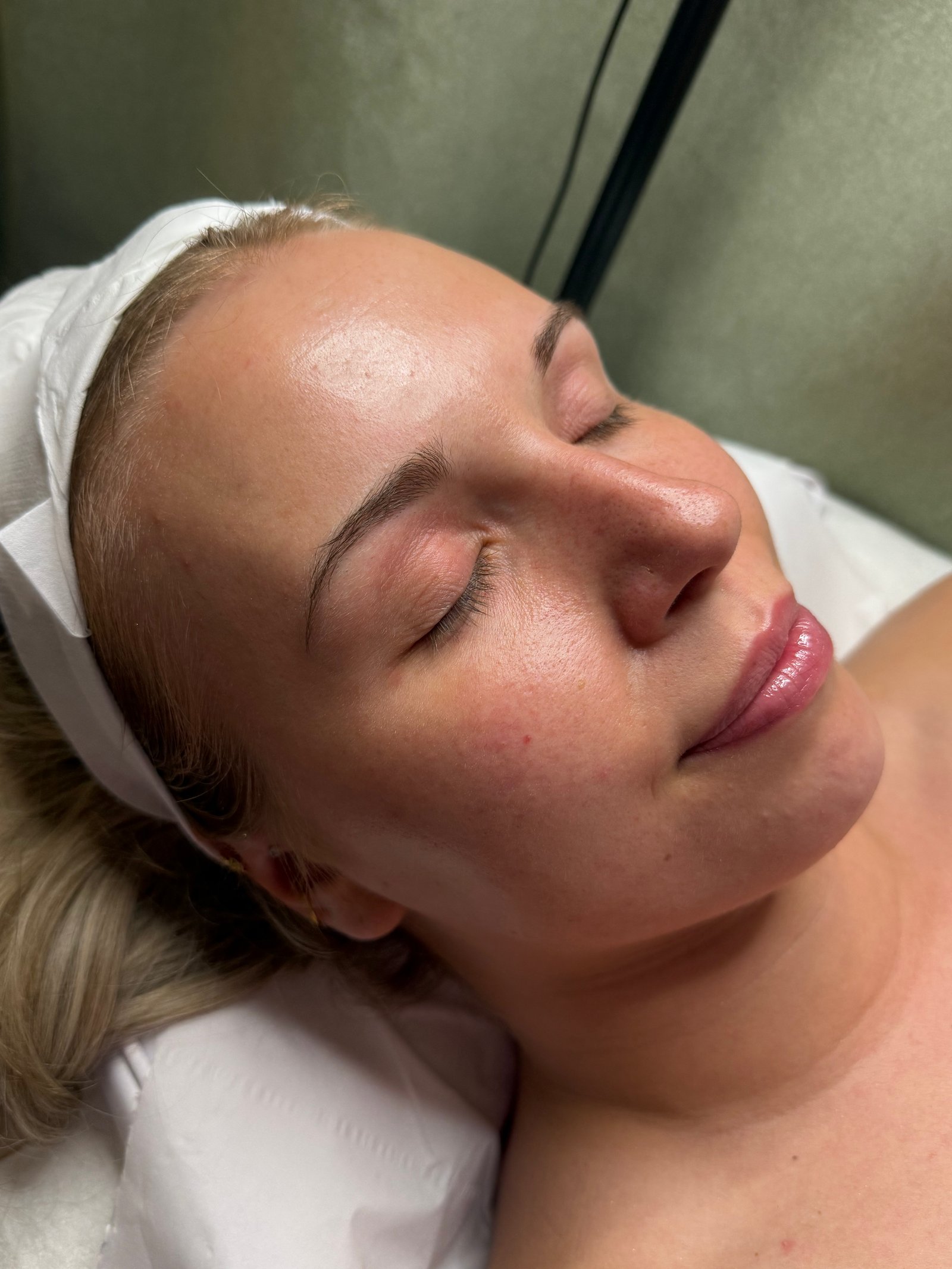 Before facial