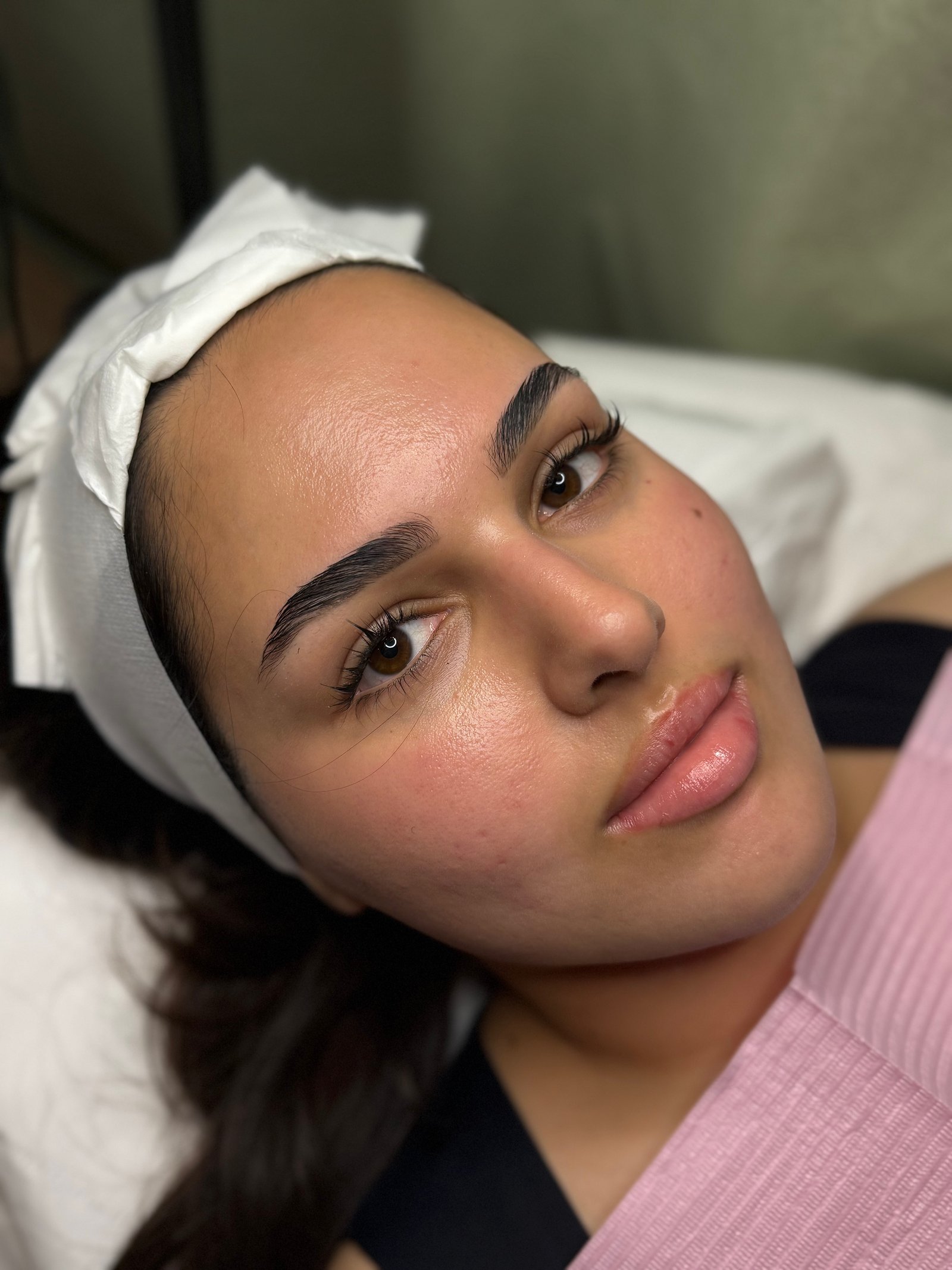 Before facial